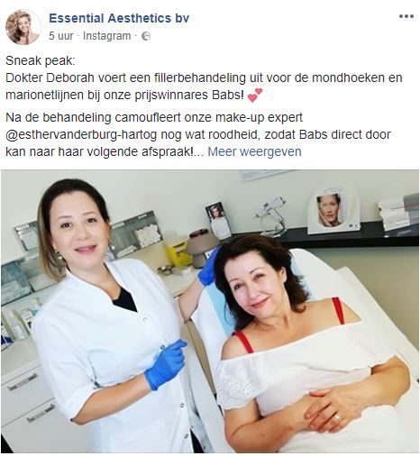 Ik won een Full Face Botox behandeling! Maar... kreeg ik Botox? 5 fillers (6)